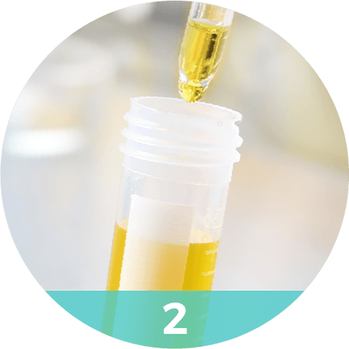 icon-howitworks-2-urine